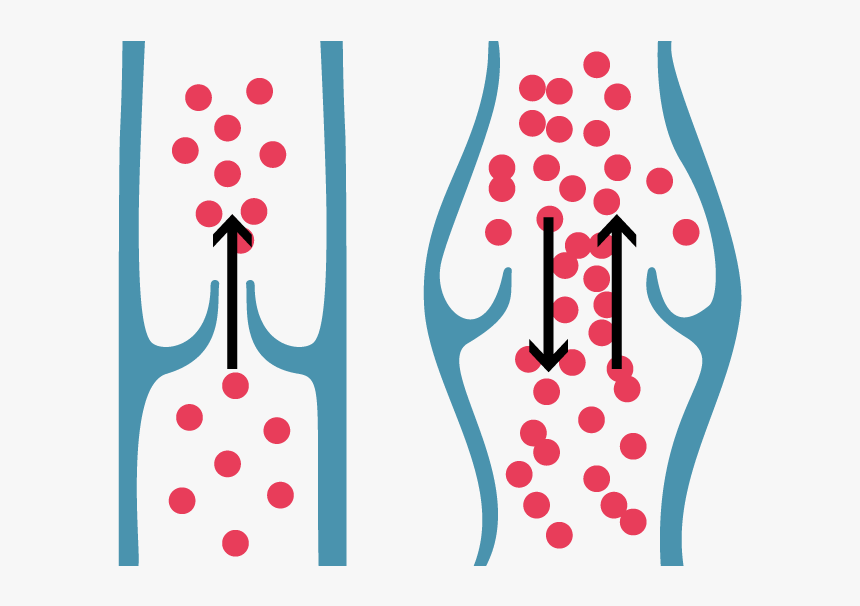 Healthy Vein Valve & Correct Blood Flow Shown On The - Healthy Veins Valves & Correct Blood Flow, HD Png Download