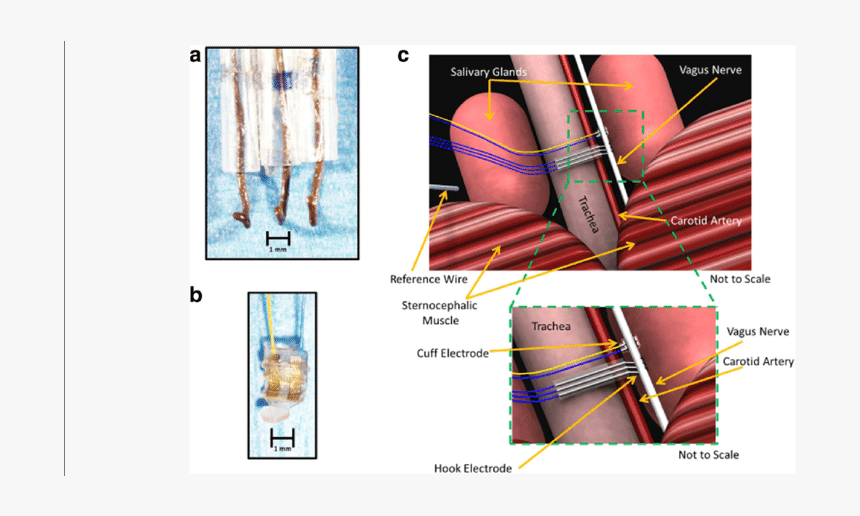 Vagus Nerve Cuff Electrode, HD Png Download