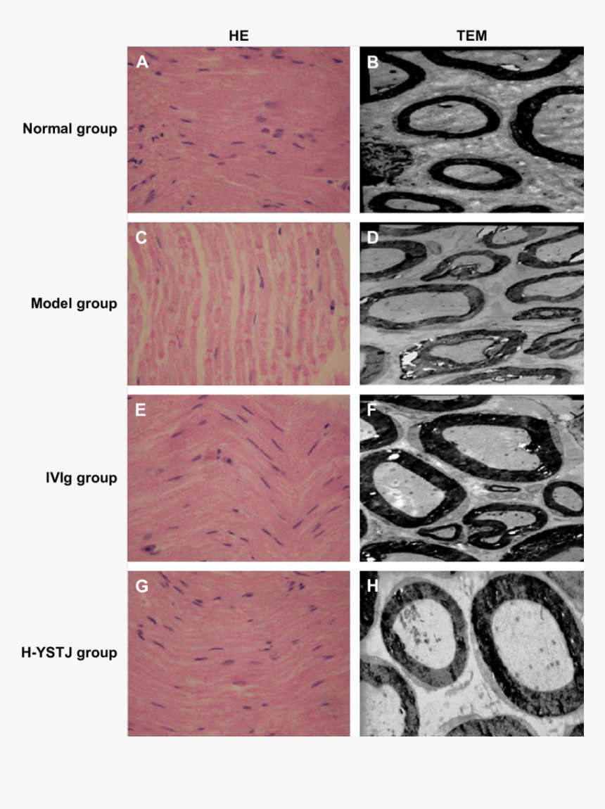Cobblestone, HD Png Download