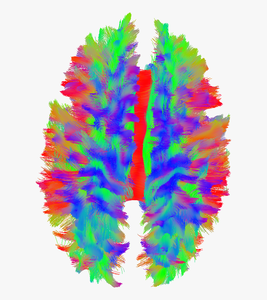 This Picture Illustrates The Nerve Fibers Of The Brain, HD Png Download
