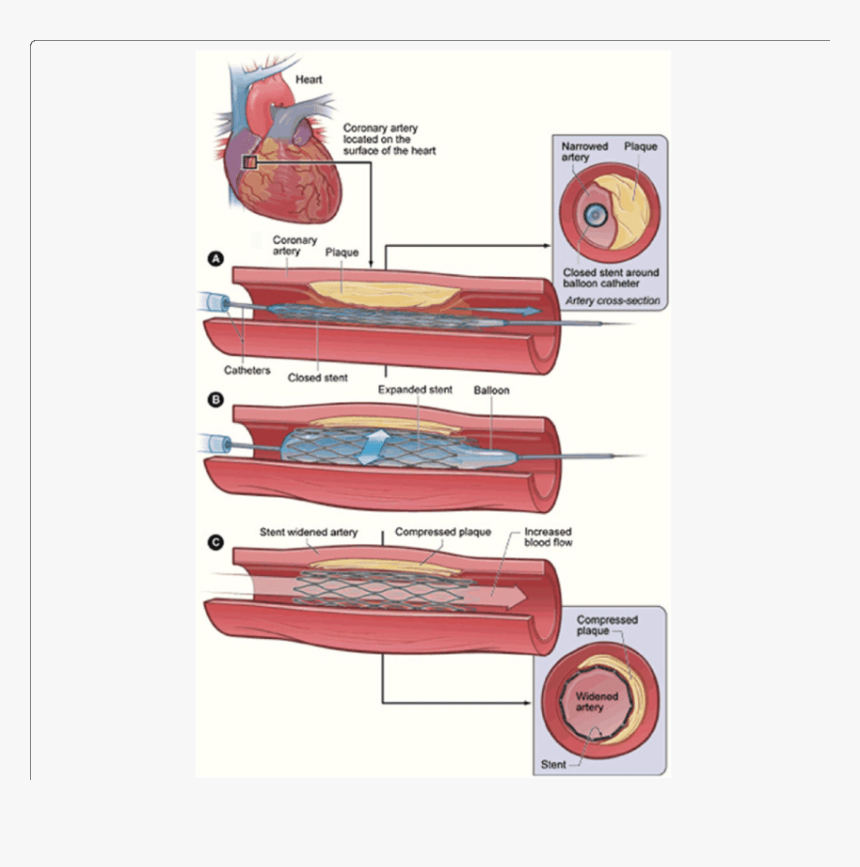 Medication Of Heart Disease, HD Png Download