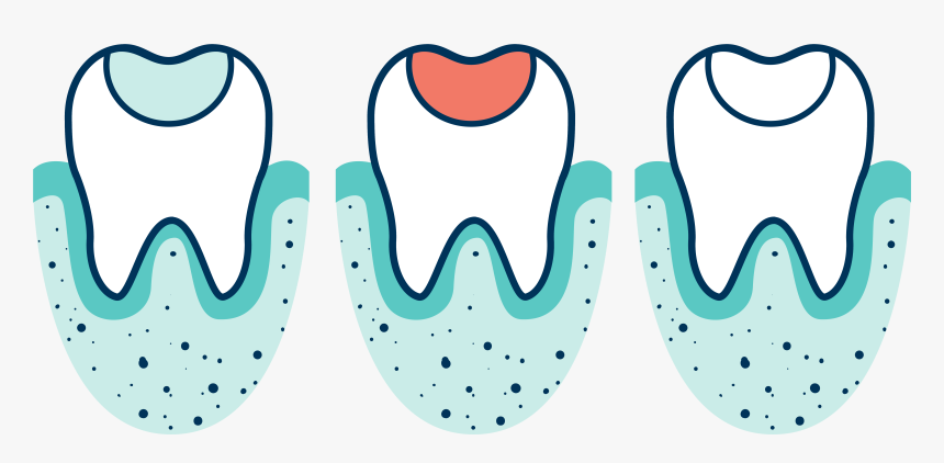 Clip Art, HD Png Download