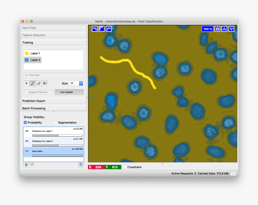 Ilastik Pixel Classification, HD Png Download