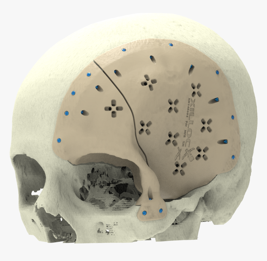 Xilloc Medical B - Skull, HD Png Download