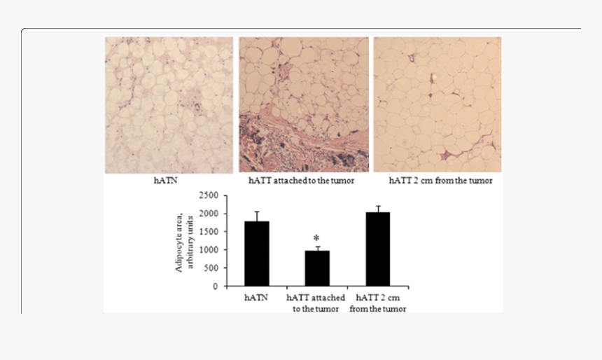 Screenshot, HD Png Download