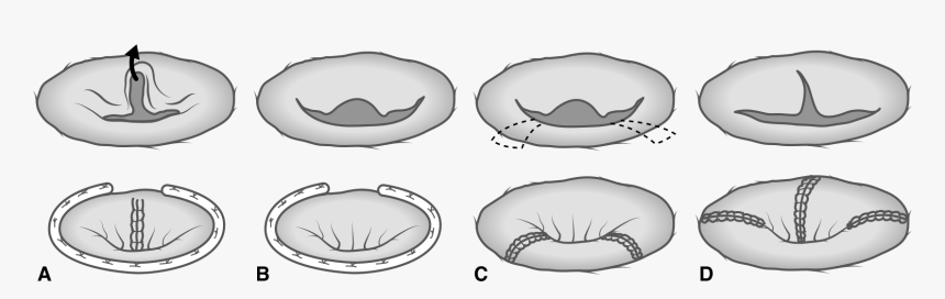 Clip Art, HD Png Download