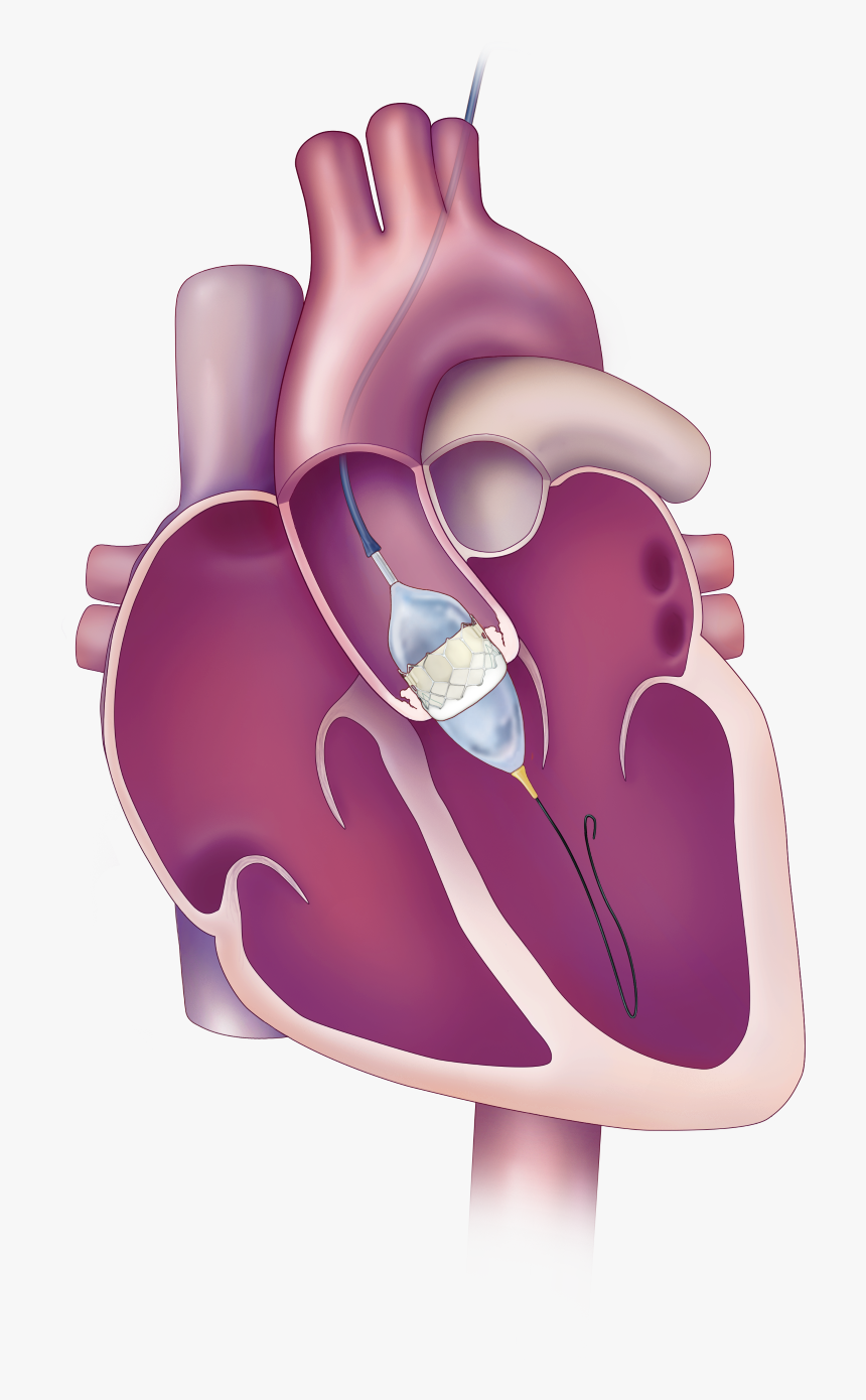Aortic Valve, HD Png Download