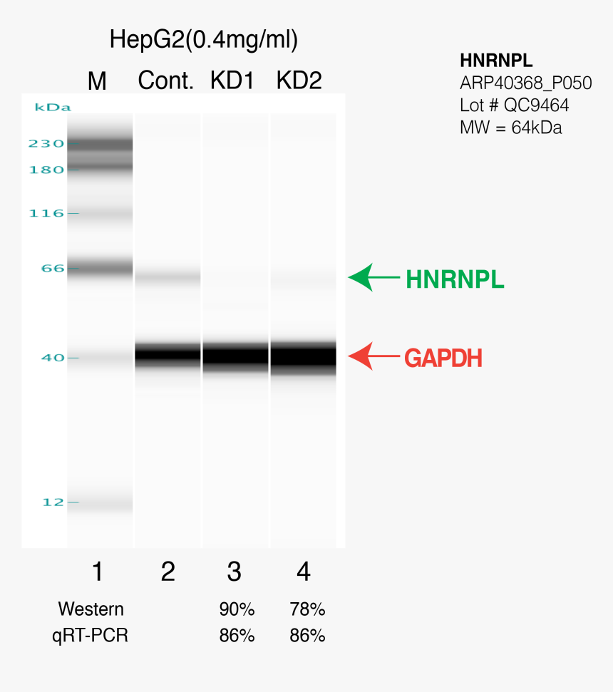 Statistical Graphics, HD Png Download