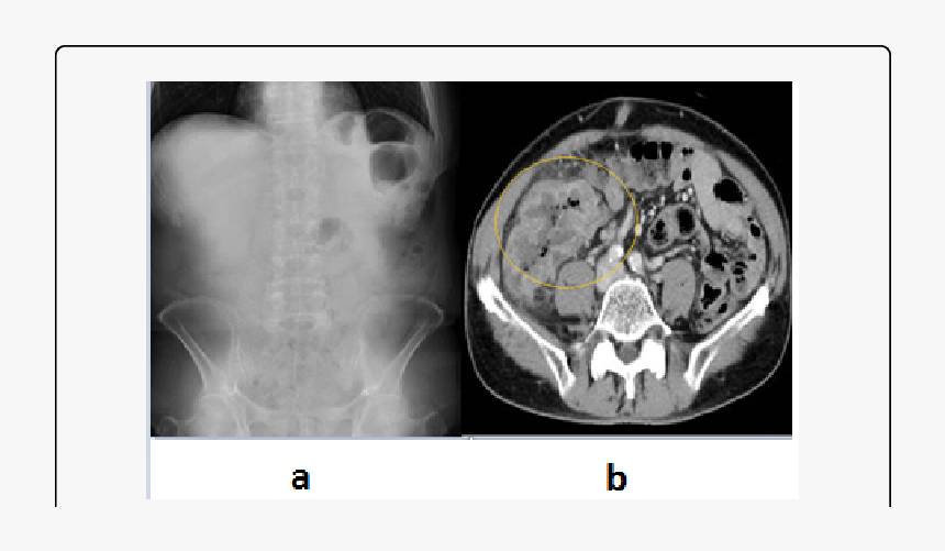 Computed Tomography, HD Png Download
