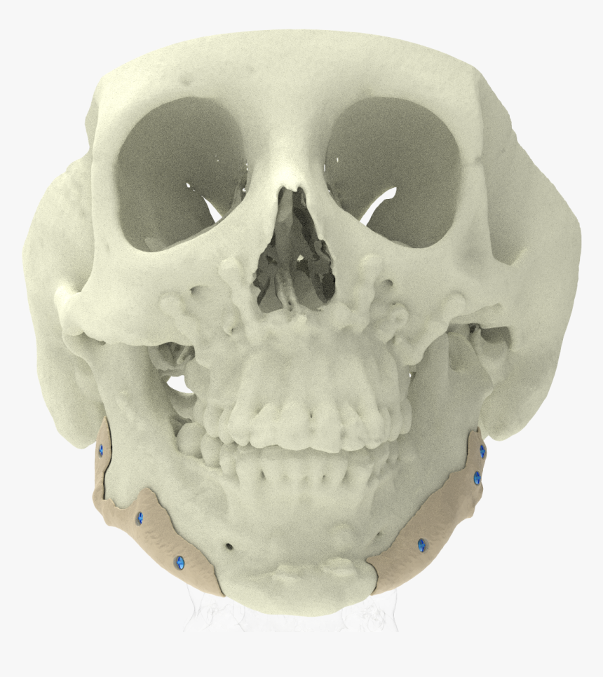 Xilloc Medical B - Skull, HD Png Download