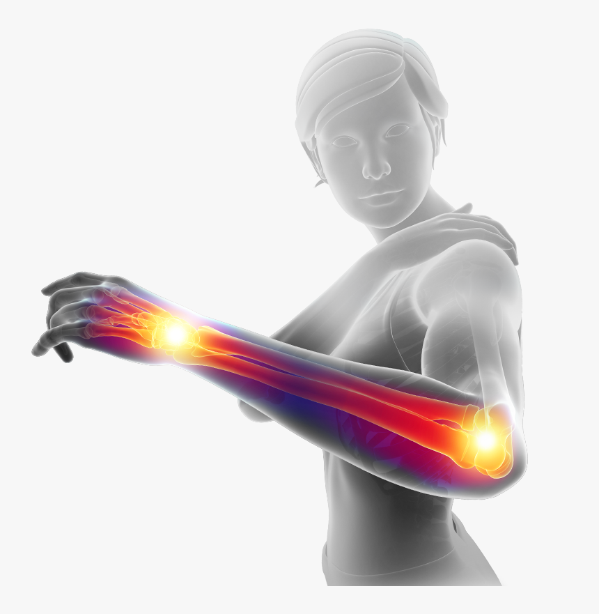 Computer Image Of Woman Looking At Inflamed Elbow - Statue, HD Png Download