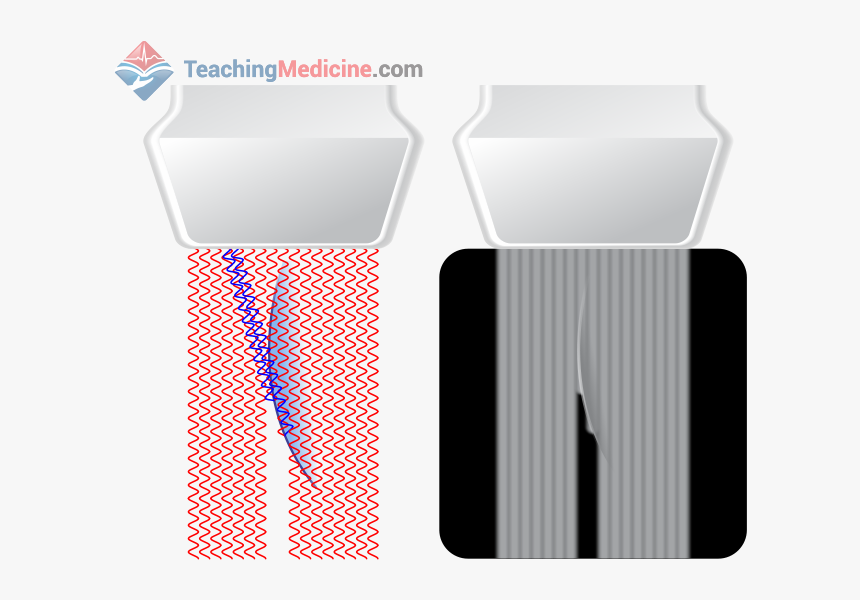 Diagram, HD Png Download