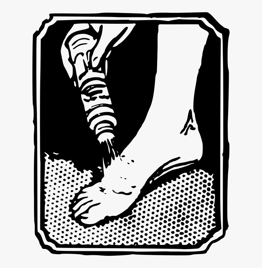 Athlete S Foot, HD Png Download