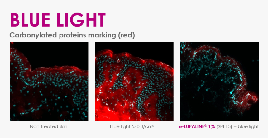 Α-lupaline® - Glitter, HD Png Download