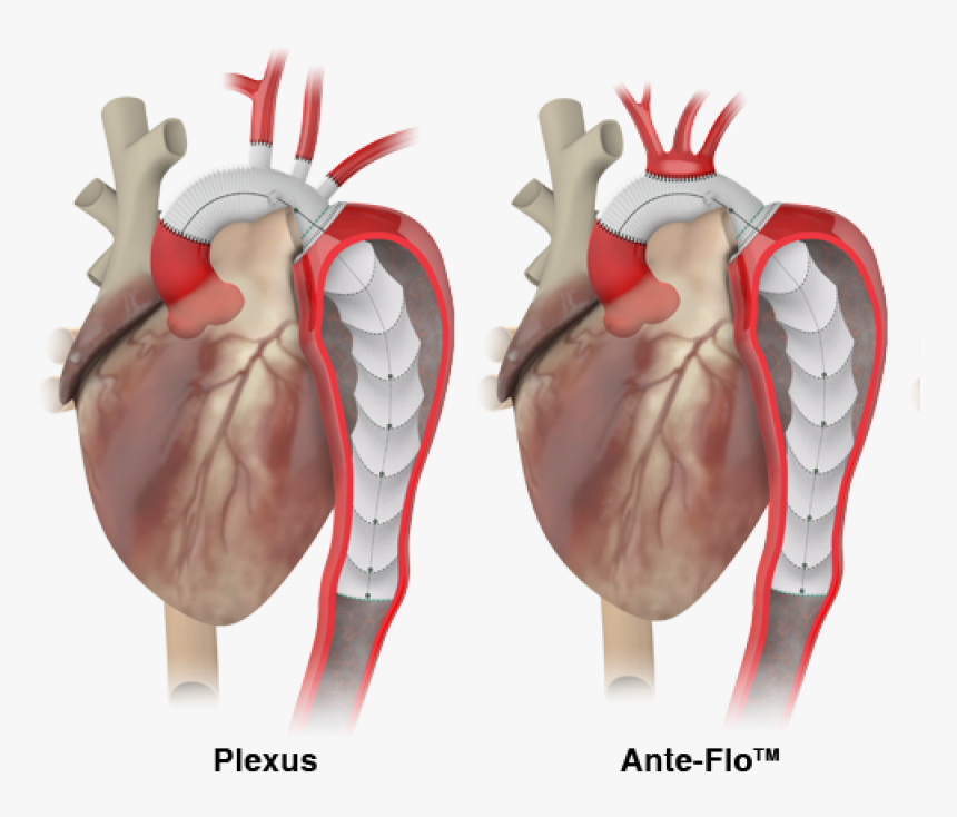 Thoraflex Hybrid, HD Png Download