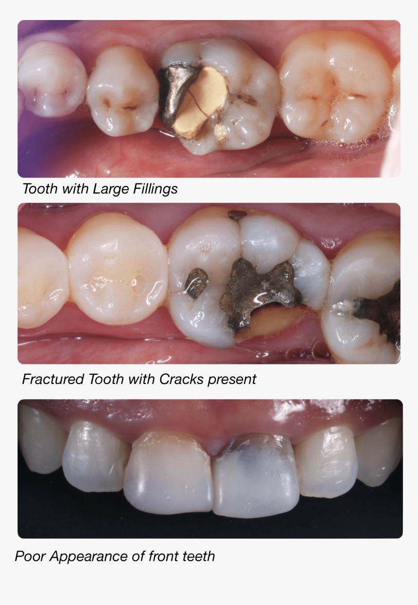 Whycrown-png, Transparent Png