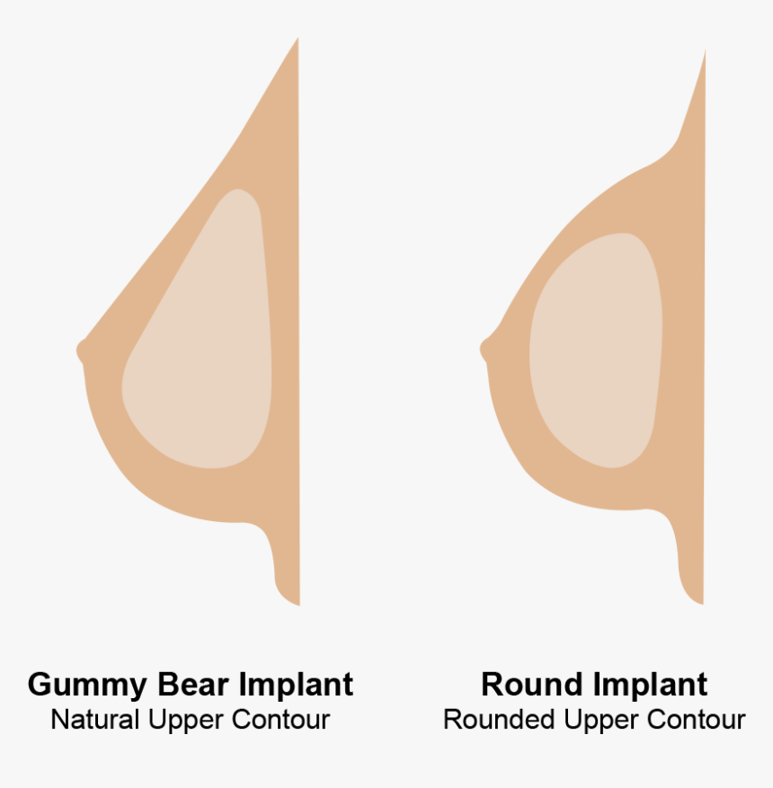 Round And Gummy Bear Implants, HD Png Download