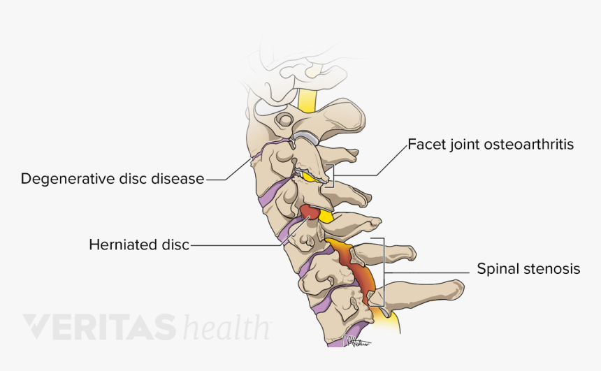 Medical Illustration Of Common Problems Affecting The, HD Png Download