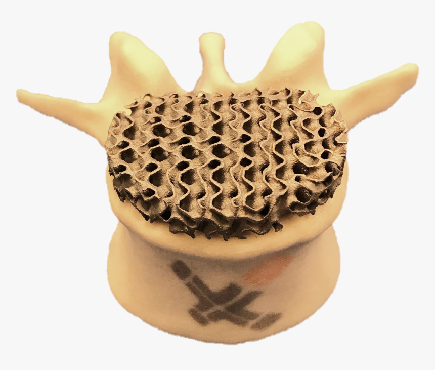 Spine Png, Transparent Png