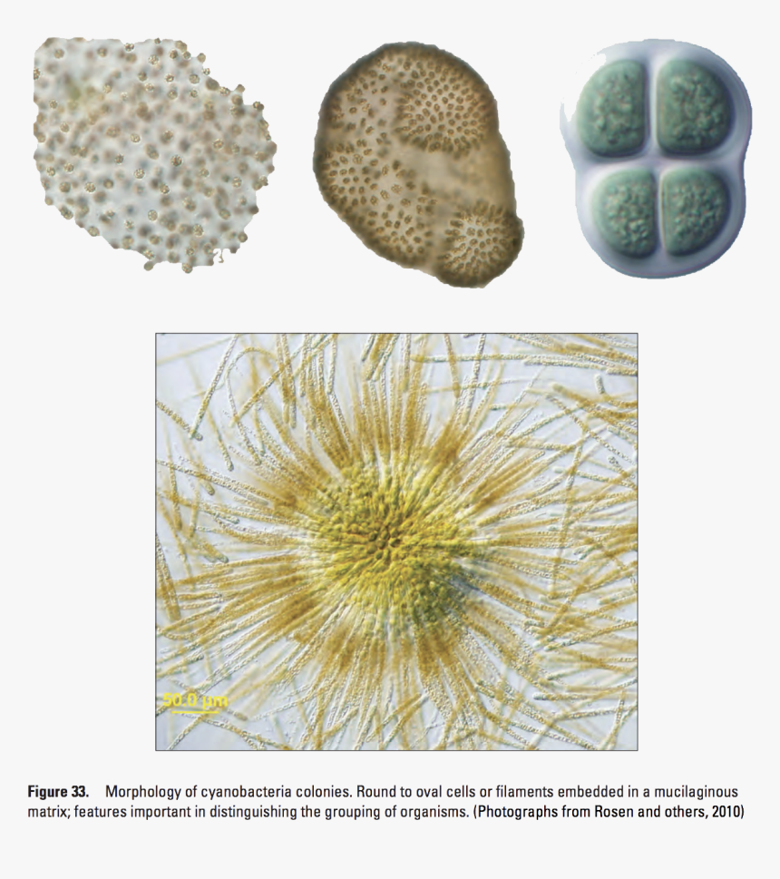 1 23 20 City Water Bacteria 2 Copy 
 Class Img Responsive, HD Png Download