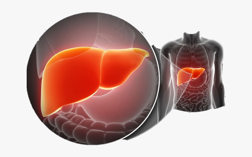 膽囊 息肉, HD Png Download