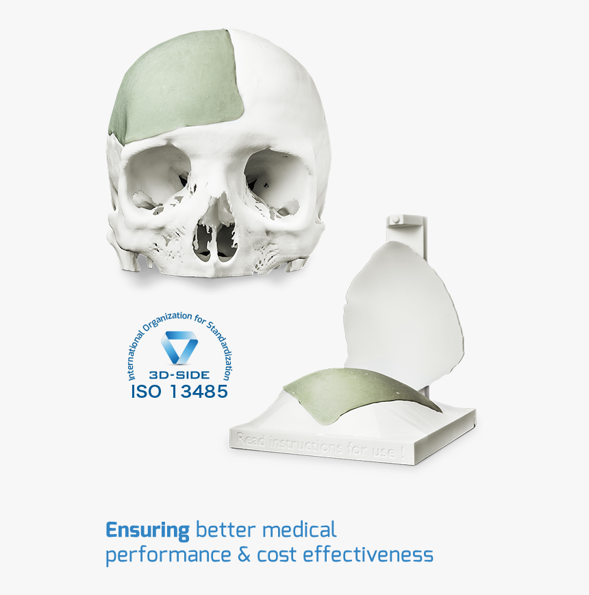 Cement Cranial Implant - Skull, HD Png Download