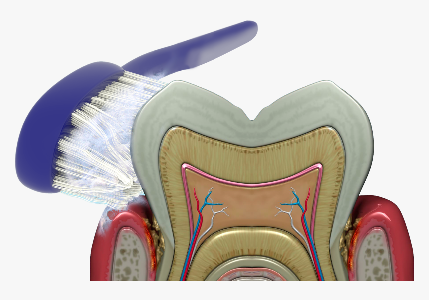 Brushing, Rinsing And Flossing Cannot Reach The Bacteria - Brush, HD Png Download