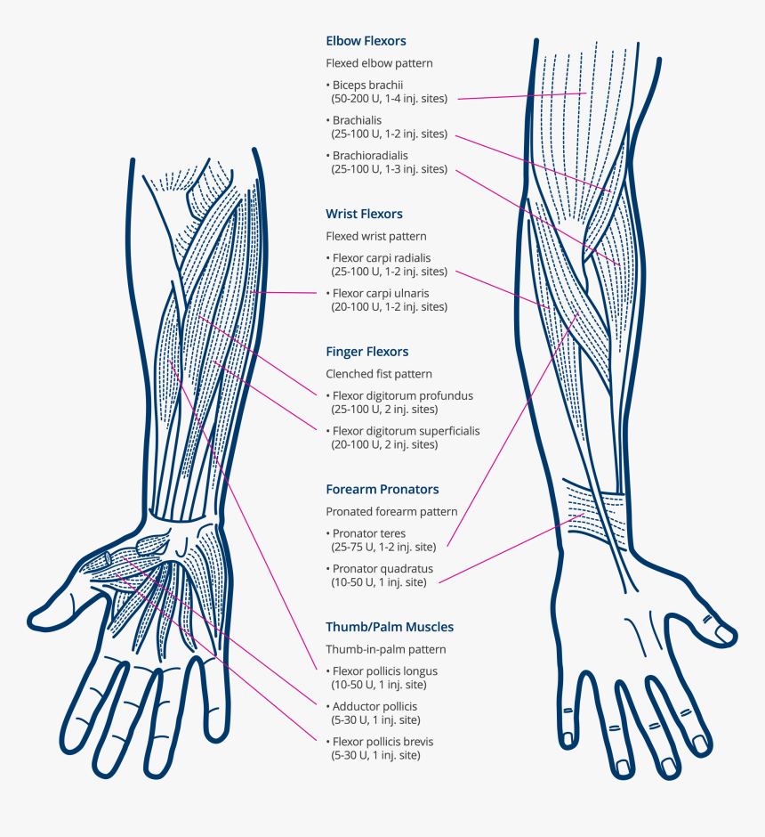 Xeomin Treatment Response - Drawing, HD Png Download