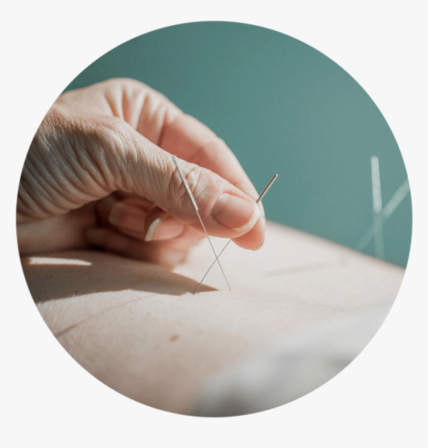 Acupuncture-circle - Circle, HD Png Download