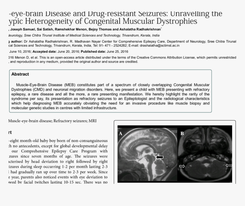 Monochrome, HD Png Download