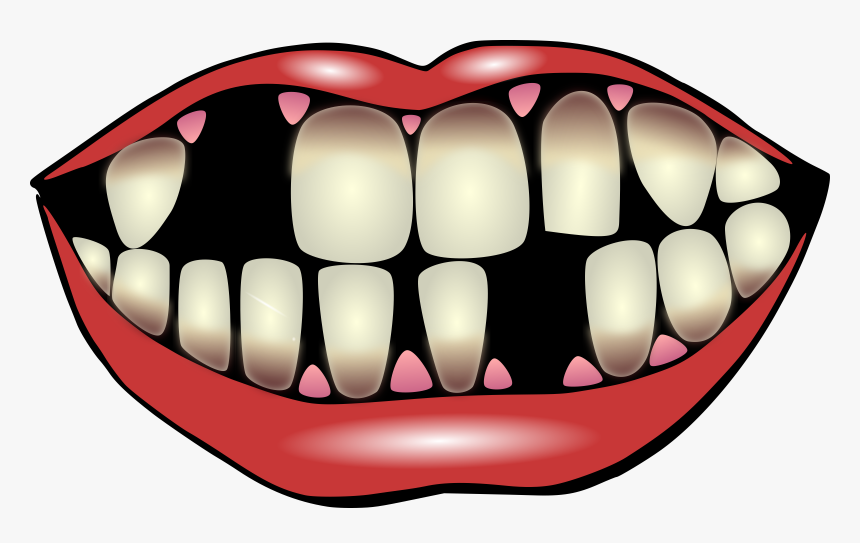 Effects Of Smoking Clipart, HD Png Download