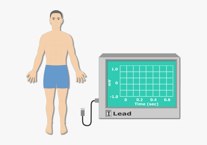 Right Arm Electrode Placement Animation Slide - Arm Electrode Placement Png, Transparent Png
