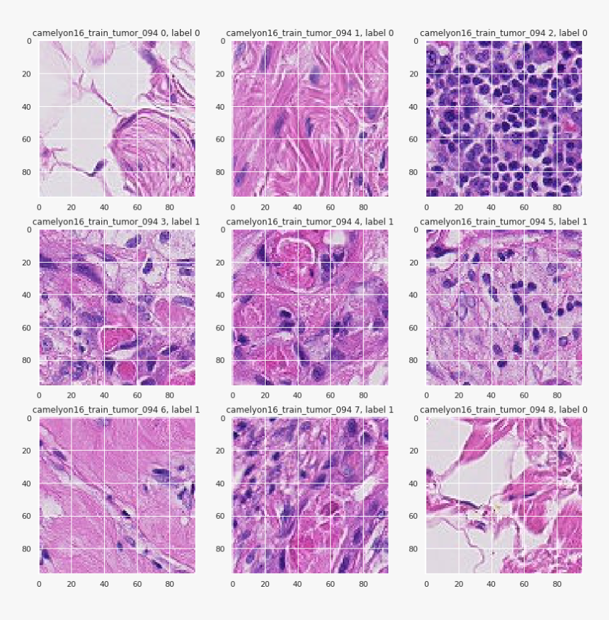 Histopathologic Cancer Detection, HD Png Download