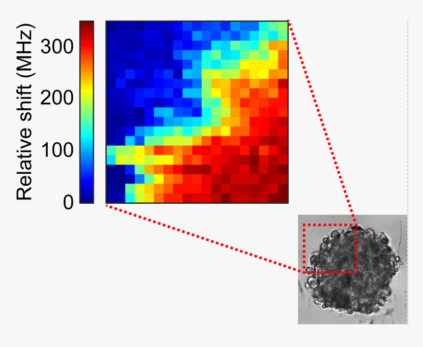 # - Brillouin Light Scattering Tumors, HD Png Download