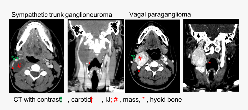 Radiology, HD Png Download