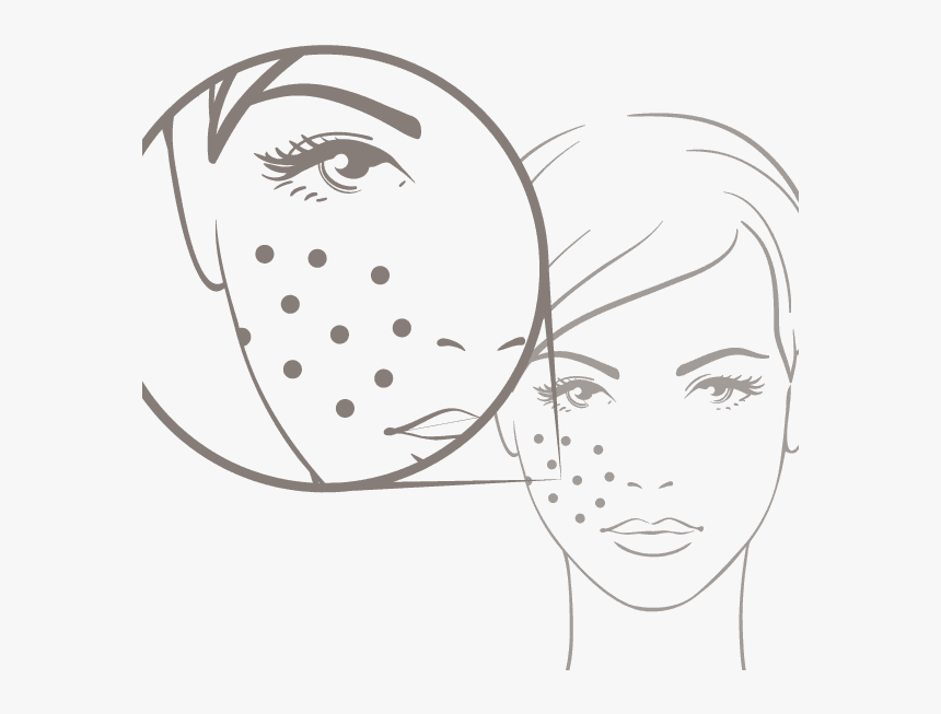 Transparent Acne Clipart - Haut Spiegel Der Seele, HD Png Download