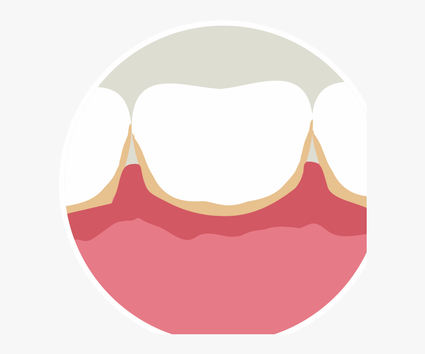Transparent Mouth Blood Png - Bleeding Gums Clipart Transparent, Png Download