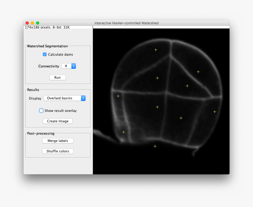 Marker Controlled Watershed, HD Png Download