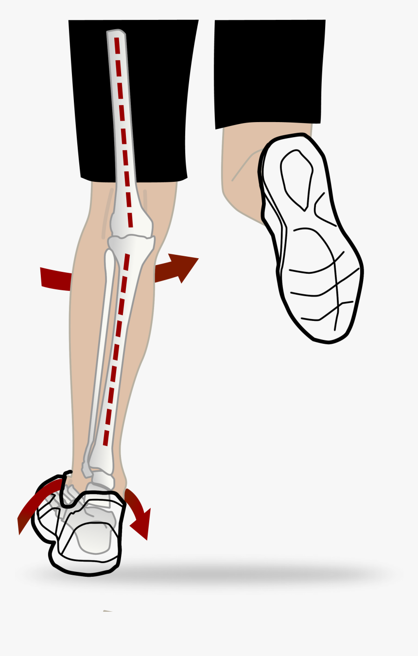 オーバー プロ ネーション 矯正, HD Png Download