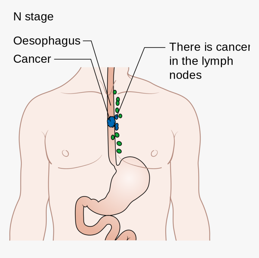 Transparent Esophagus Png - Cartoon, Png Download