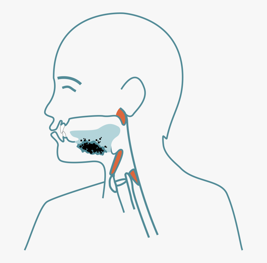 What Is Dysphagia Symptoms - Afl Football Field Template, HD Png Download