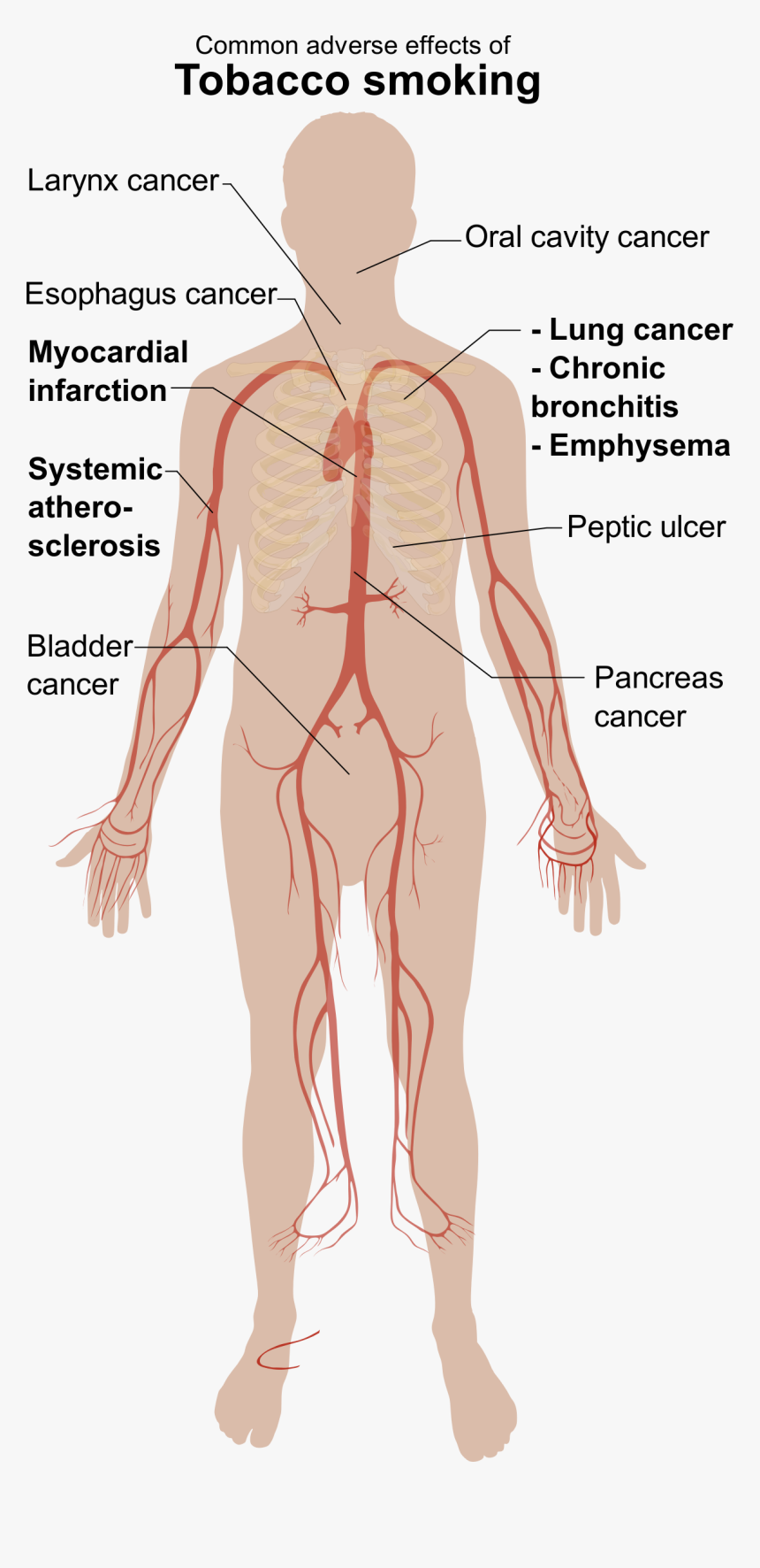 Adverse Effects Of Tobacco Smoking Clip Arts - Tobacco A Silent Killer, HD Png Download