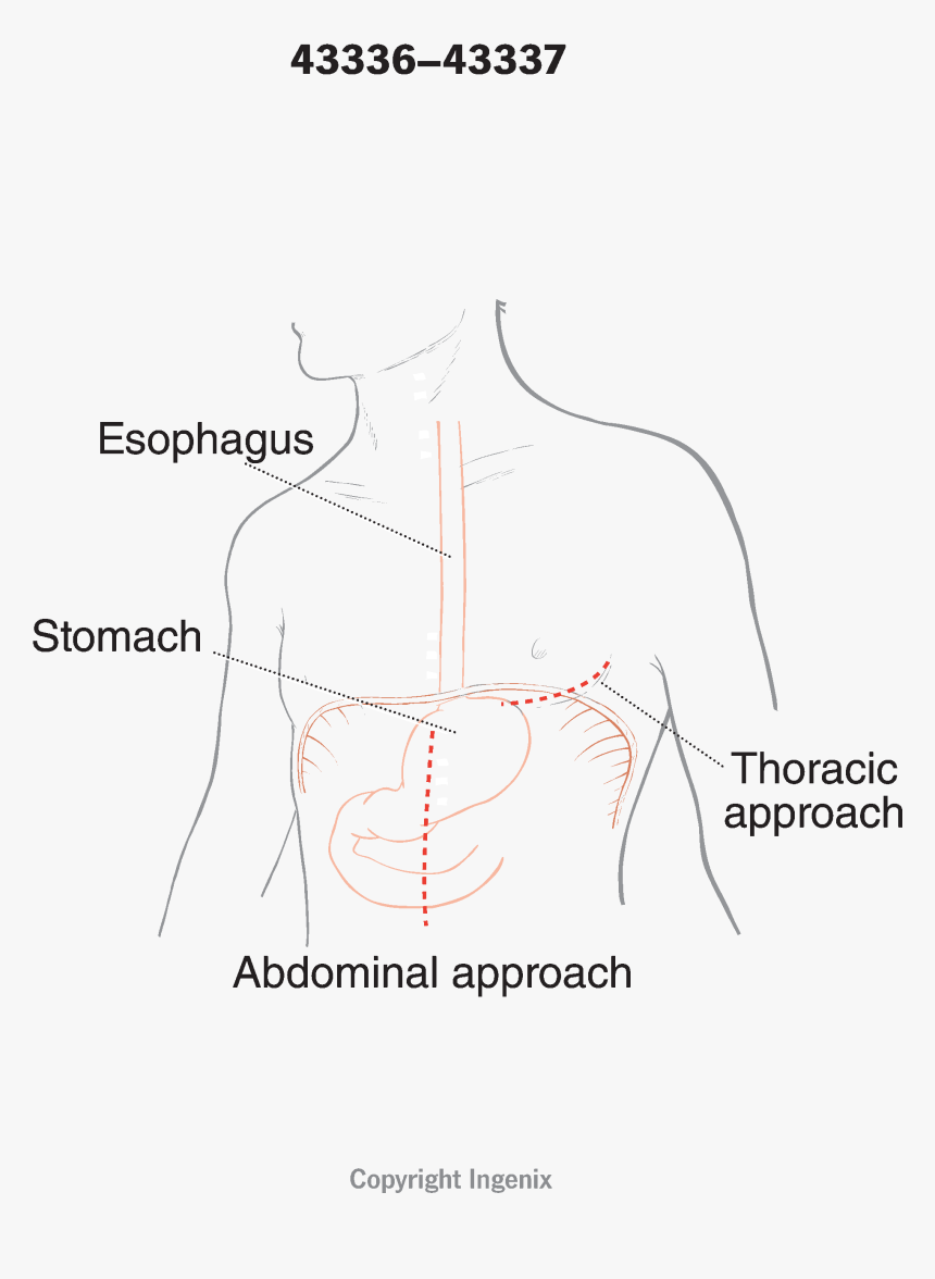 Diagram, HD Png Download